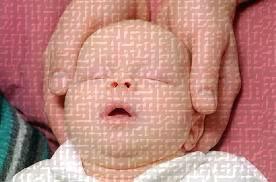 craniosacrale2