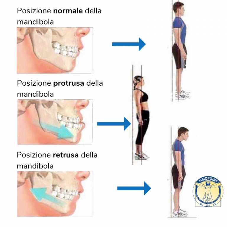 Posizione normale della mandibola