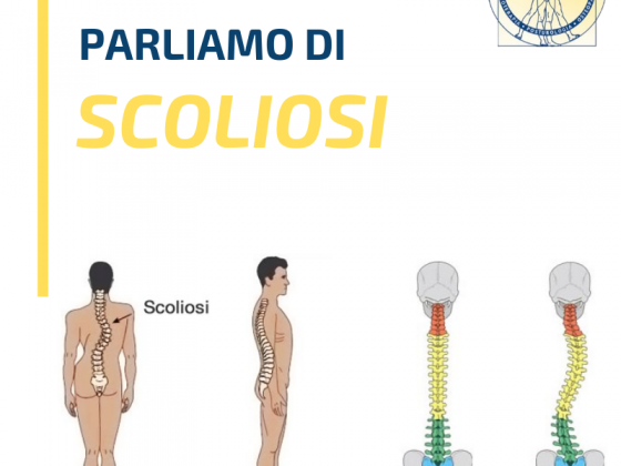 QUALe LA DIFFERENZA
